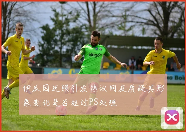 伊瓜因近照引发热议网友质疑其形象变化是否经过PS处理