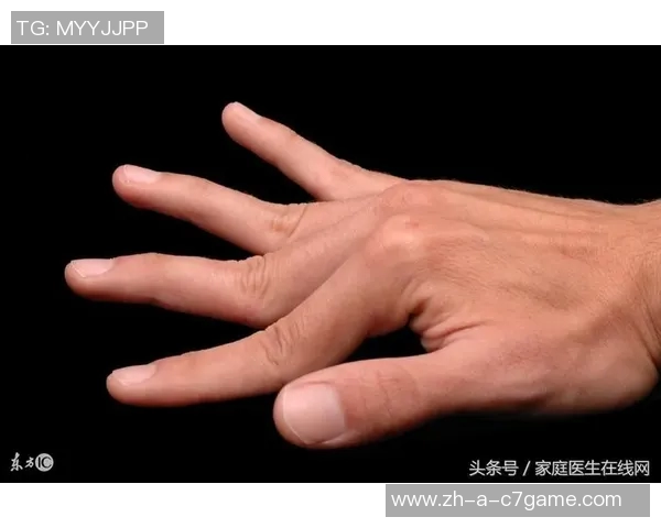 森林狼球员莱昂纳德米勒右手小拇指受伤两周后将进行复查